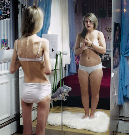 anorexia-foto-capa